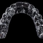 Zâmbetul discret al ortodonției: beneficiile aparatului dentar Invisalign