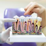 Cum implanturile dentare revoluționează restaurarea orală